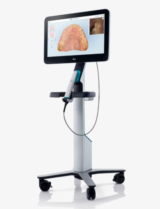 Itero Scanner